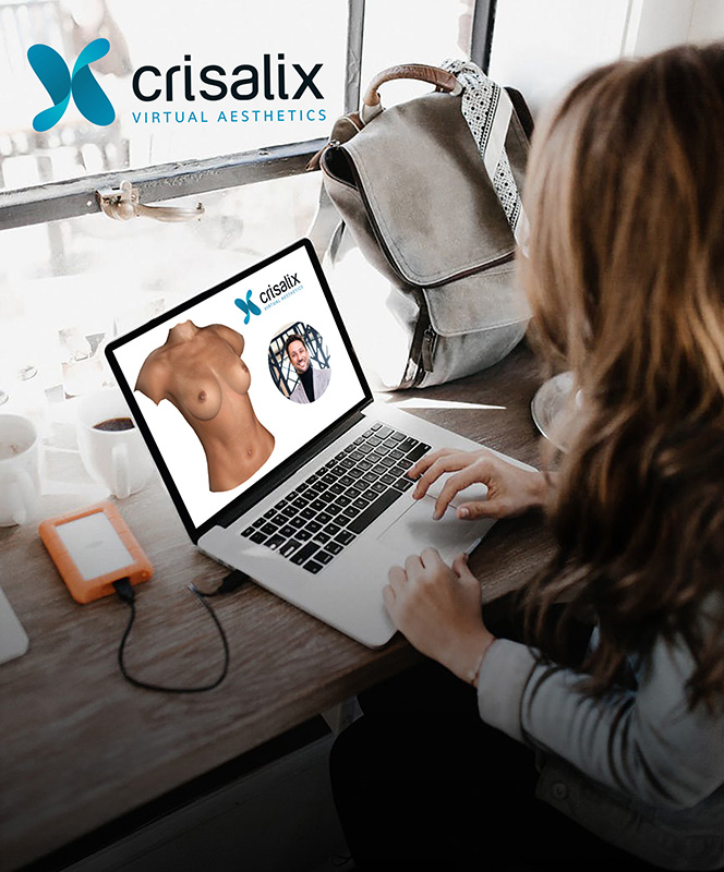 crisalix simulation 3D