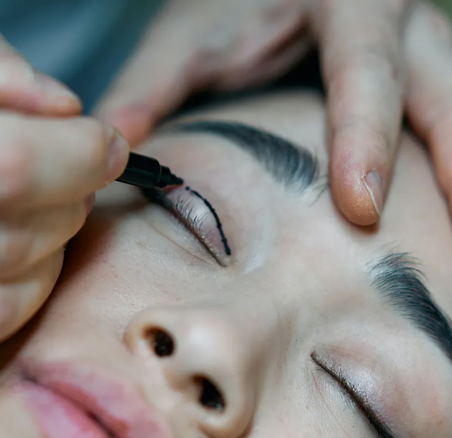 Bl&eacute;pharoplastie