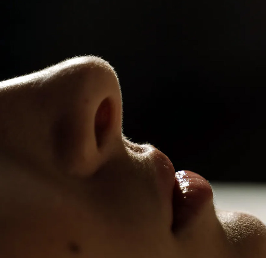 Rhinoplastie m&eacute;dicale