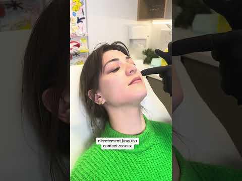 Augmenter le volume de ses pommettes gr&acirc;ce aux #injections